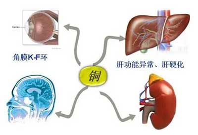 人體91视频网下载數據能夠準檢測出但身體中微量元素銅超標會引起疾病發生